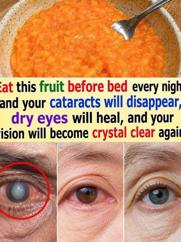 The Bedtime Fruit Ritual That Could Save Your Vision from Cataracts and Dry Eyes
