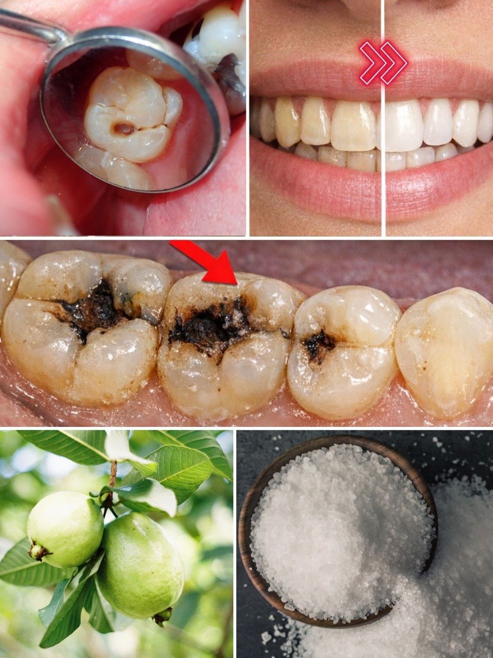 ¡Adiós Caries! El Secreto Natural de las Hojas de Guayaba que Transformará Tu Sonrisa en Días (¡3 Remedios Imprescindibles!) 🌿🦷