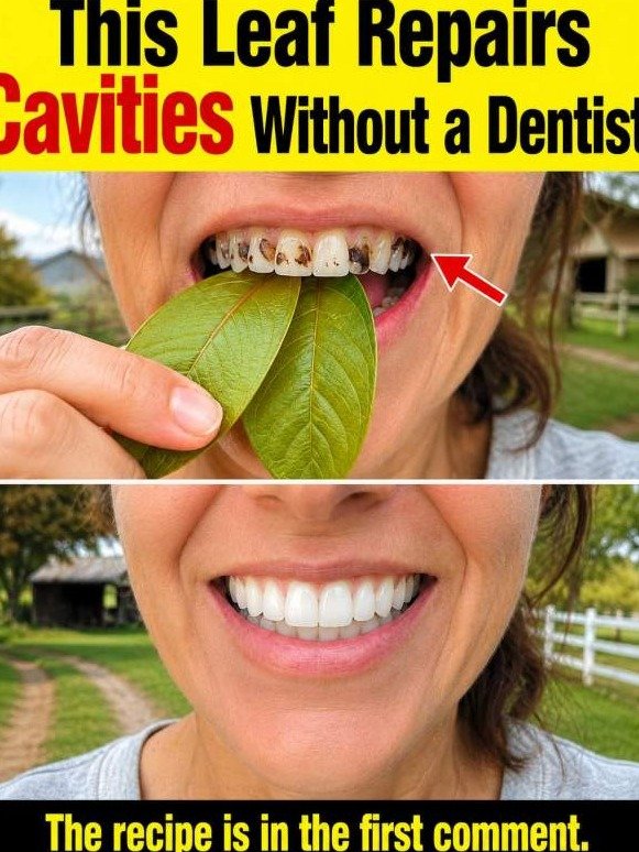 ¡Alerta Viral! Tu Dentista NO Quiere Que Sepas Esto: La Hoja de Guayaba y el Enjuague Revolucionario que Borra la Caries