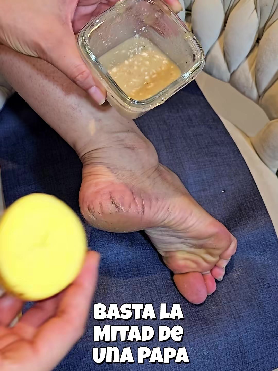Adiós Talones Agrietados: El Truco de la Papa Que Transforma Tus Pies Mientras Duermes