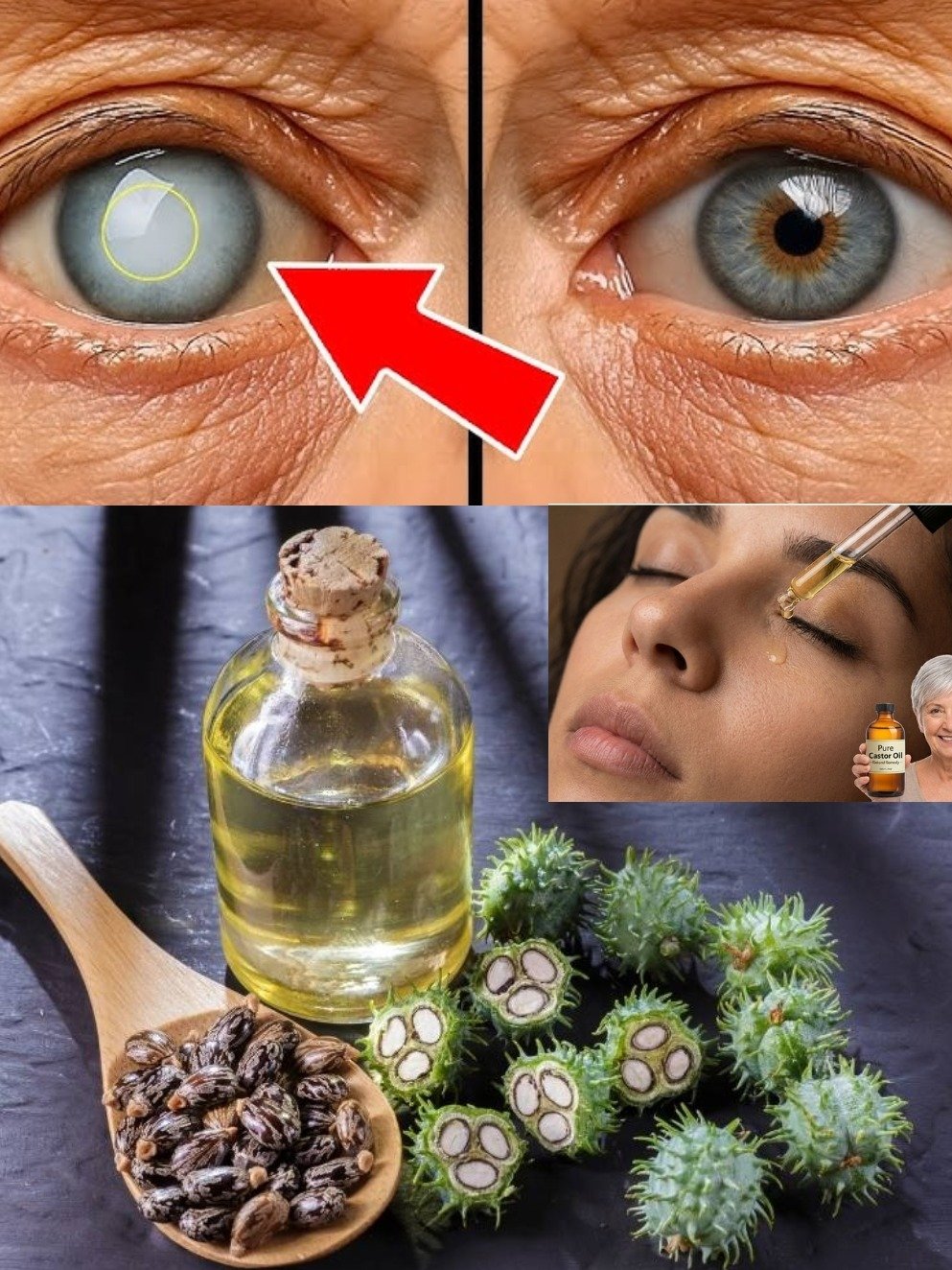 Blurry Vision? 3 Simple Kitchen Staples That Could Save Your Eyesight