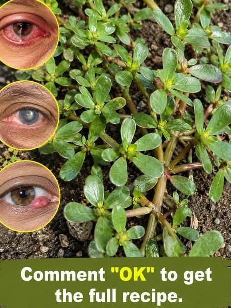 Stop Ignoring That Common Weed: It May Be the Missing Link to Ending Chronic Dry Eyes