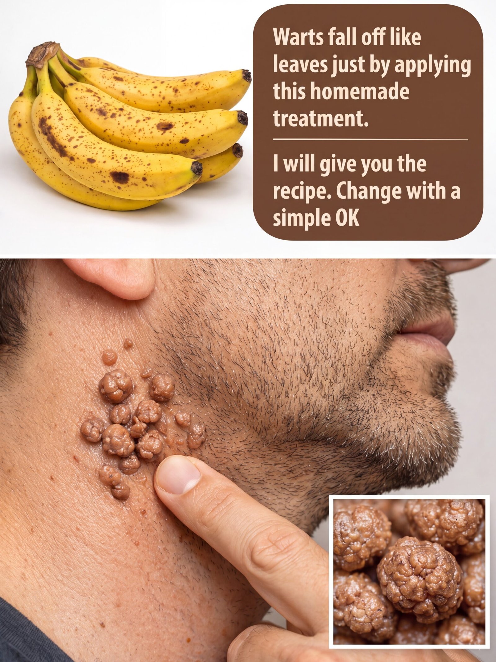 Warts Begone? The Viral Banana Peel Hack Everyone's Talking About – But Is It a Miracle Cure or a Dangerous Myth?