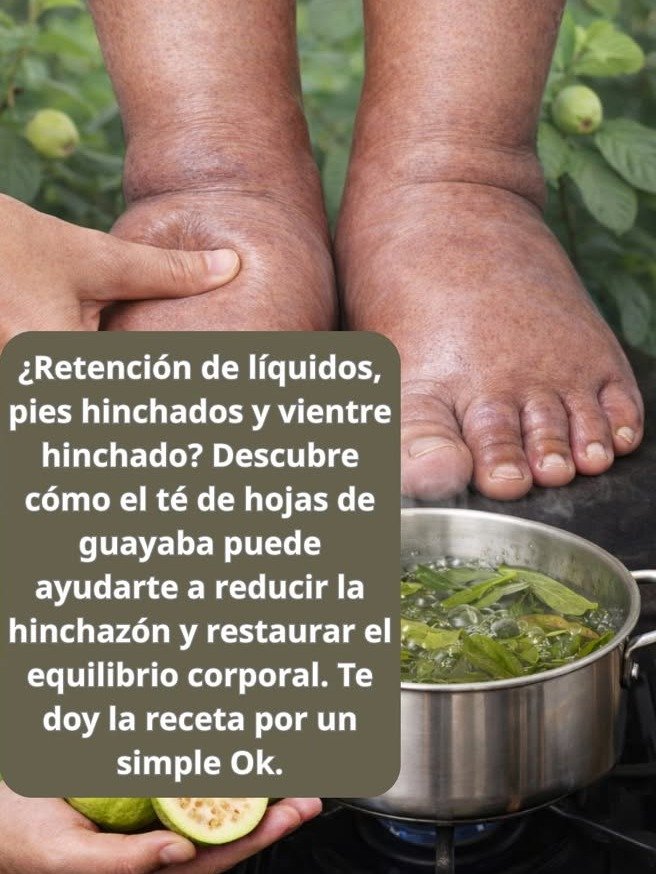 🌿 ¿Hojas de guayaba contra la retención de líquidos? La verdad detrás del remedio viral que está arrasando