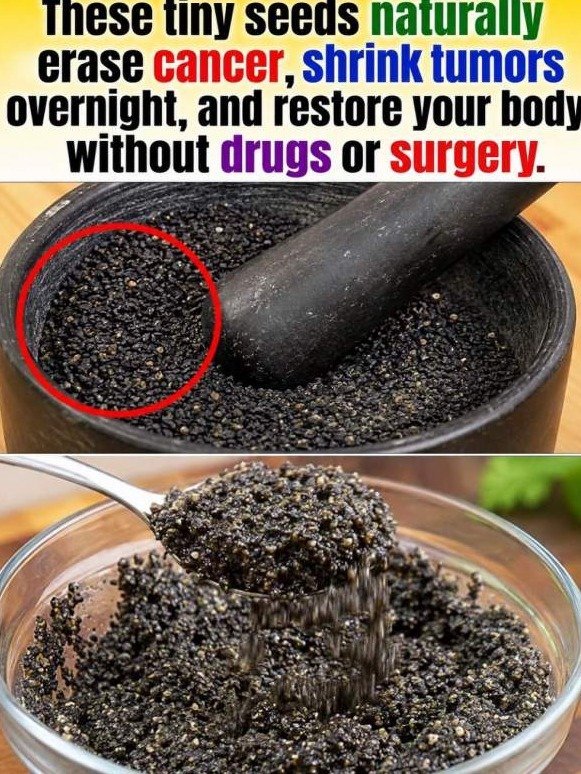 The Dangerous Black Seed Myth: Why Viral 'Cancer Cures' Are Putting Your Health at Risk