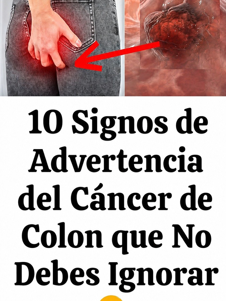 10 señales de alerta temprana del cáncer de colon que tu cuerpo intenta decirte (¡No las ignores!)
