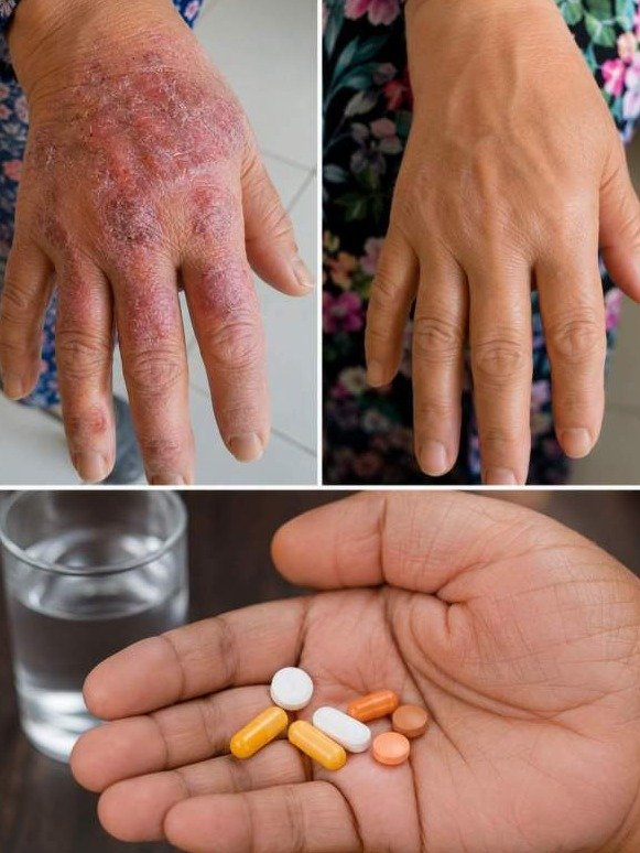 ¡Alerta Roja! Tu Inflamación Crónica Te Está Robando la Vida: Descubre Cómo la Cúrcuma y el Jengibre Son Tu Arma Secreta (y Barata)