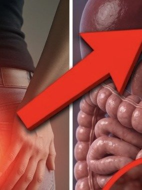 10 Subtle Colon Cancer Warning Signs Most People Ignore (Don't Miss These!)