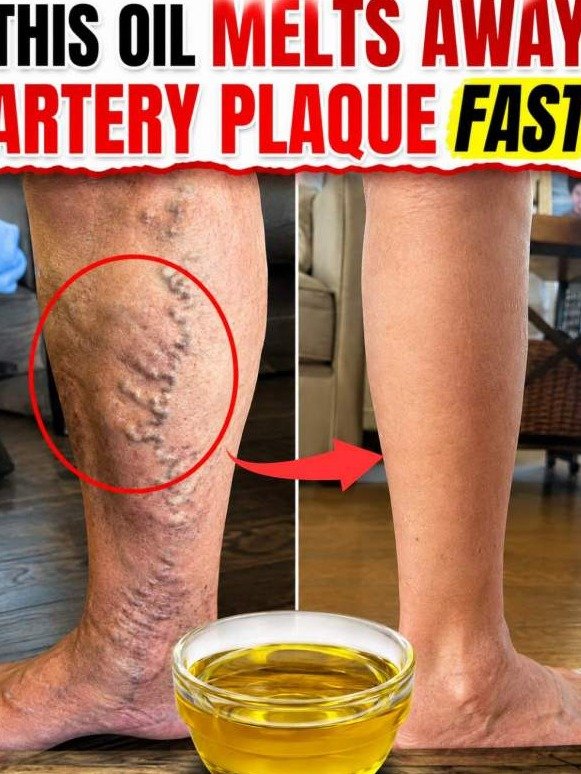 Stop Blaming Your Age: How This Kitchen Staple Unclogs Your Legs and Restores Circulation