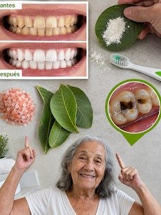 ¡El Secreto Mejor Guardado! Blanquea Tus Dientes Naturalmente con Hojas de Guayaba y Luce una Sonrisa Impecable en Semanas