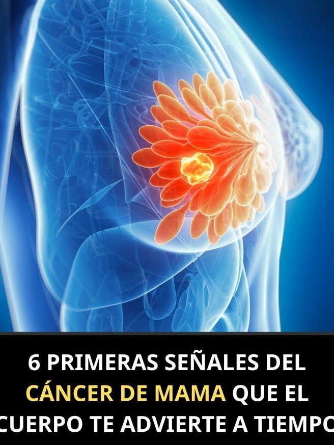 ¡URGENTE! Tu Cuerpo Te Está Advirtiendo: Las 6 Primeras Señales SILENCIOSAS de Cáncer de Mama (¡No Las Ignores!)