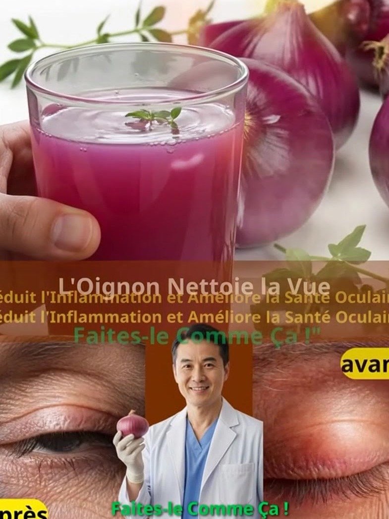 ¡El Secreto de tu Cocina Revelado! Transforma tu Vista en Solo 5 Días con la Cebolla: El Remedio Natural que Revitaliza Ojos, Riñones y Controla la Diabetes Tipo 2