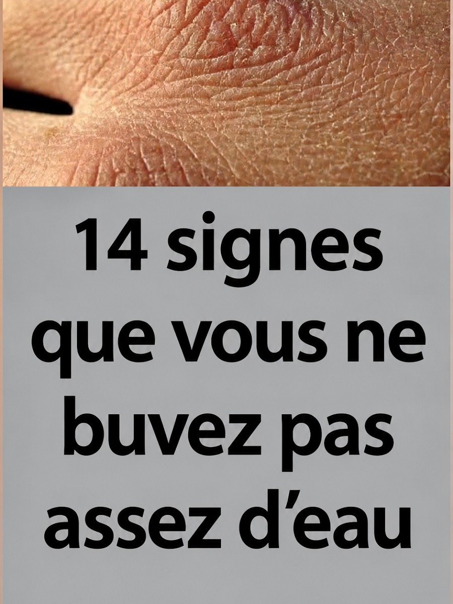 💧 ¿Tu Cuerpo Te Está Gritando? 14 Señales Alarmantes de Que NO Bebes Suficiente Agua (¡La #7 te SORPRENDERÁ!)