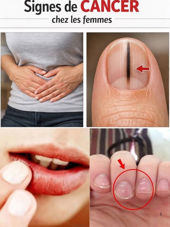 ¡Alerta Urgente! 14 Señales VISIBLES de Cáncer que Millones de Mujeres Ignoran (y DEBES Identificar YA)