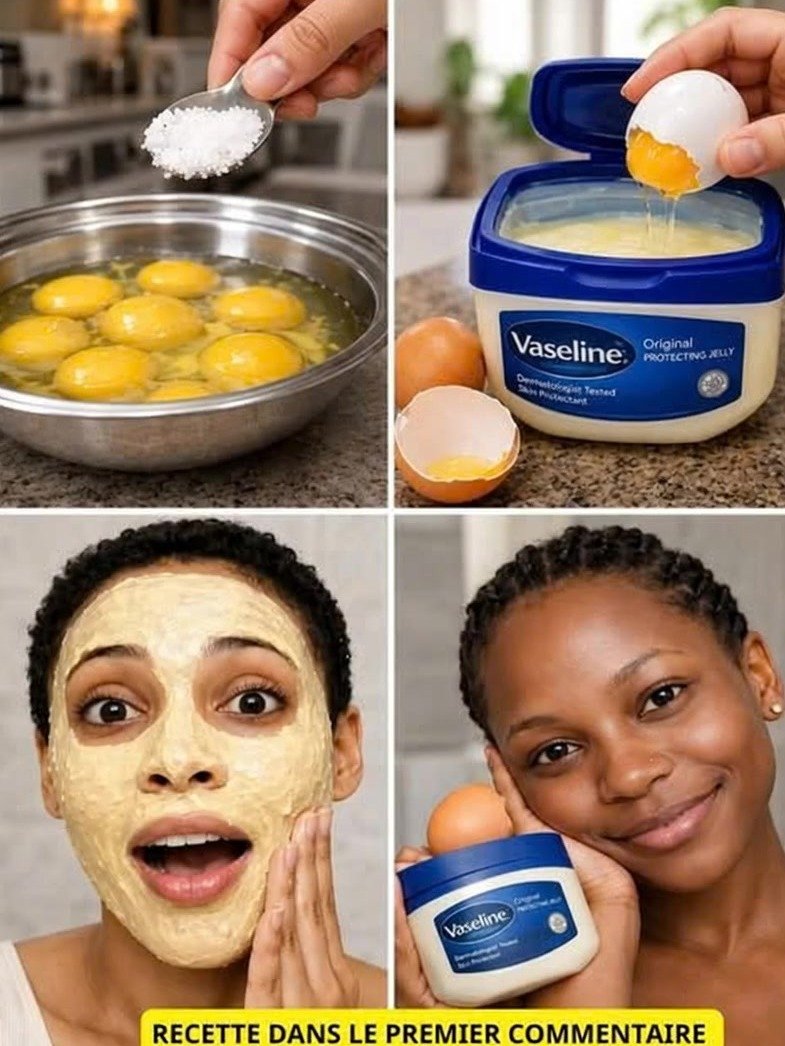 ¡El Secreto Antiedad Viral que NADIE Te Contó! Vaselina y Huevo para un Efecto Botox Natural en Casa ✨🥚🌿