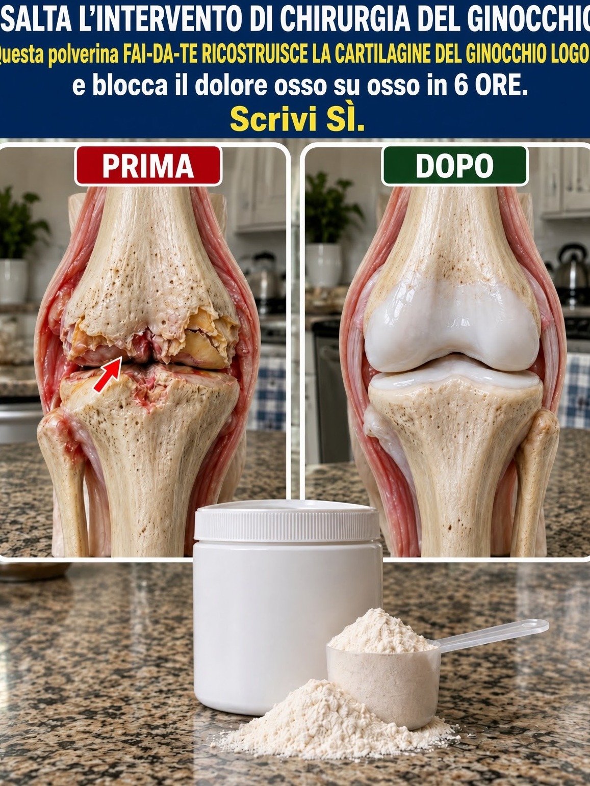 Is Bone-on-Bone Knee Pain Ruining Your Life? This Simple Nightly Ritual Could Be The Secret You're Missing!