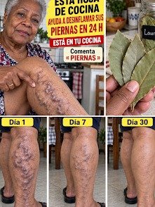 Piernas Hinchadas y Pesadas: ¿El Laurel es el Remedio Milagroso o te estás perdiendo la VERDADERA solución? ¡Atención!