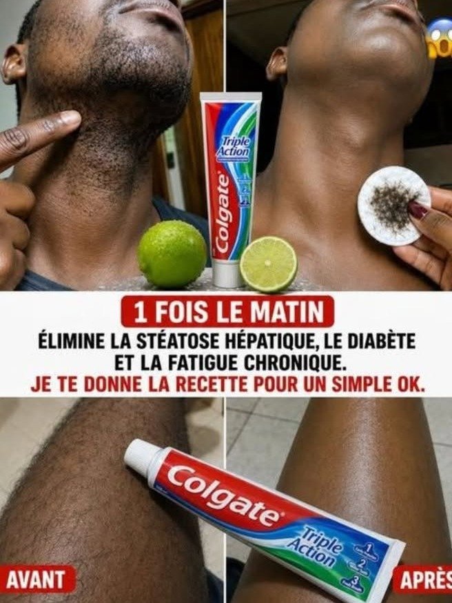 ¡Alerta Mujeres +50! El Peligroso Secreto de la Pasta Depilatoria Viral que Nadie te Revela (y cómo proteger tu piel HOY)