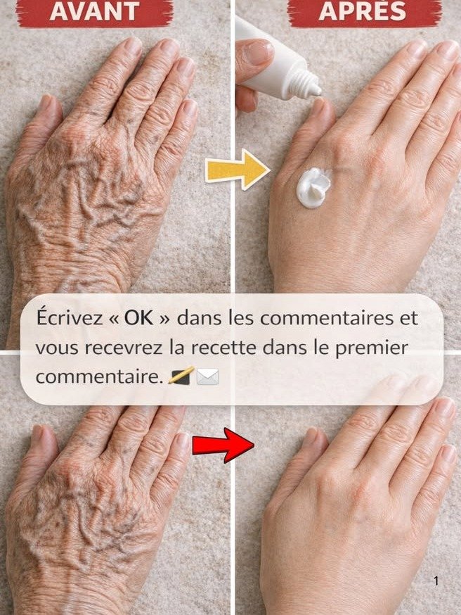El Secreto Viral para Manos y Brazos de Aspecto Joven: ¡Borra Arrugas y Manchas con ESTE Remedio Natural en Días!