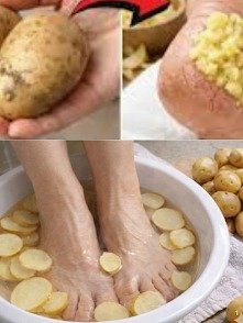 Descubre el Ingrediente Secreto de Cocina para Talones Increíblemente Suaves en Días (¡Es una Patata!)