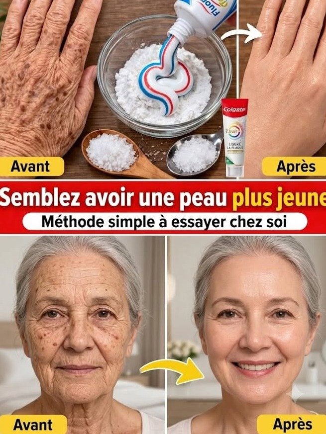 ¡Mi Esteticista Me Odia! El Remedio Casero Viral que Borra Arrugas y Manchas de Manos y Brazos (¡Parece Cirugía!)