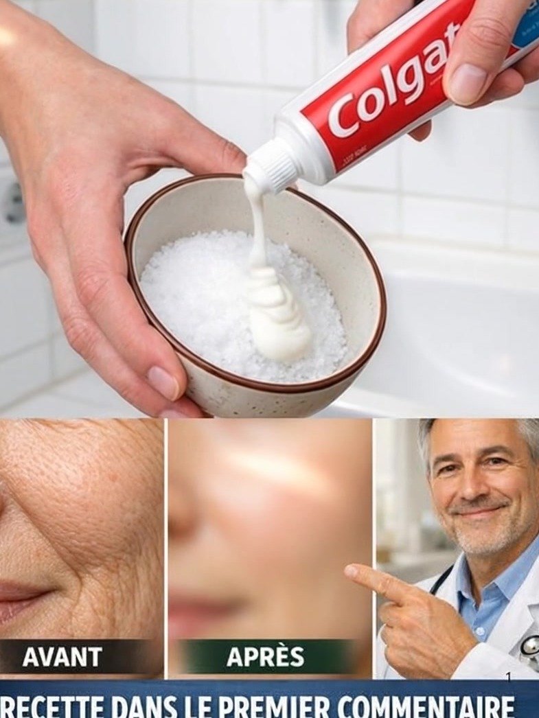 ¡Parece Cirugía Estética! La Receta Natural que Borra Arrugas y Manchas de Manos y Brazos y te Deja Joven de Nuevo