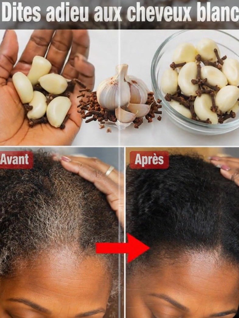 El Secreto Vir@l que NADIE te contó: ¡Dile ADIÓS a las Canas para Siempre con Ajo y Clavo de Olor!