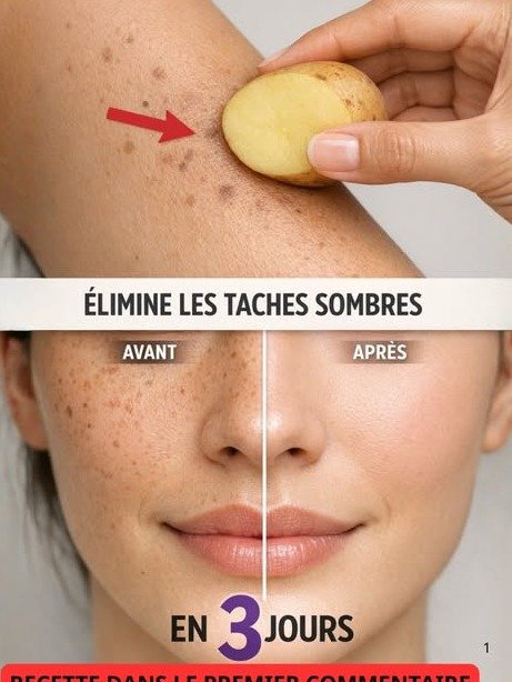 ¡El Secreto Mejor Guardado para Tu Piel! Descubre el Mascarilla Casera de Maicena, Bicarbonato y Limón que Borra las Manchas de la Edad y Te Deja una Piel Radiante (¡No lo creerás!)