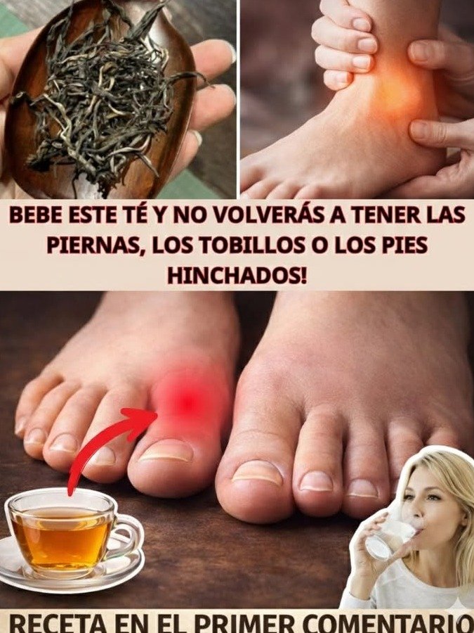 ¡Adiós Piernas Hinchadas! El ÚNICO Té Natural que Necesitas Para Sentirte Ligero y Activo en Días