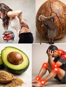 ¡No Tires MÁS el Hueso de Aguacate! El Remedio Natural OCULTO que Elimina tus Dolores Articulares y de Espalda